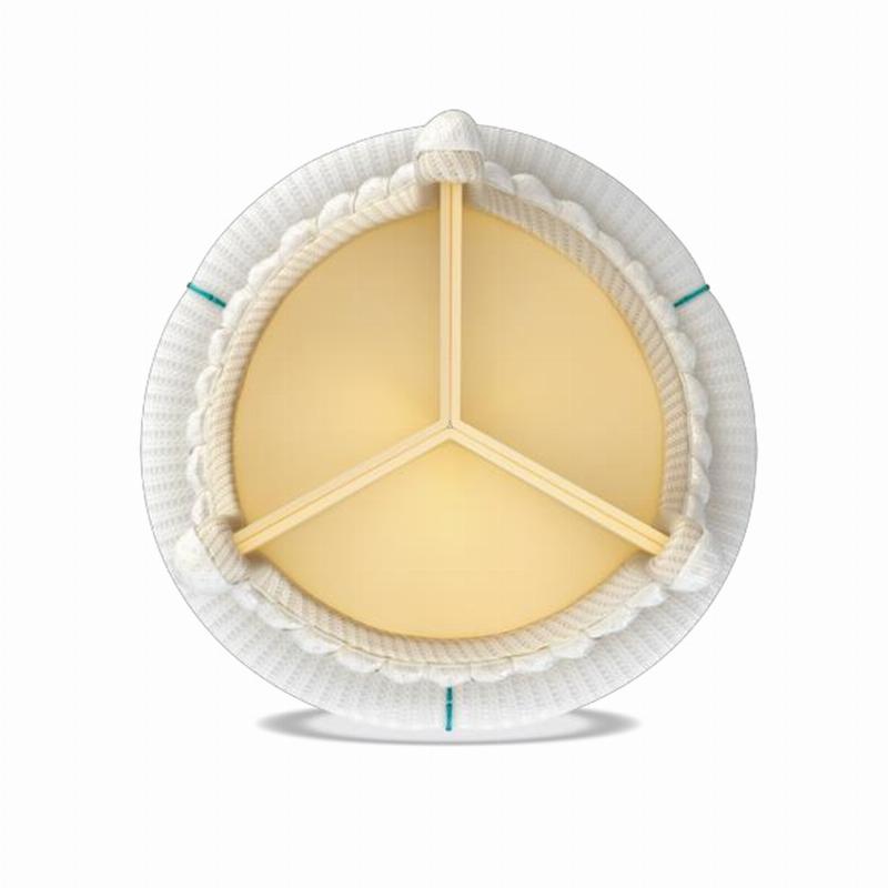 Авалус 400 біопротез